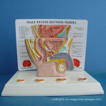 Männliche Abdomen Medizinische Anatomie Modell mit Beschreibung (R110203)